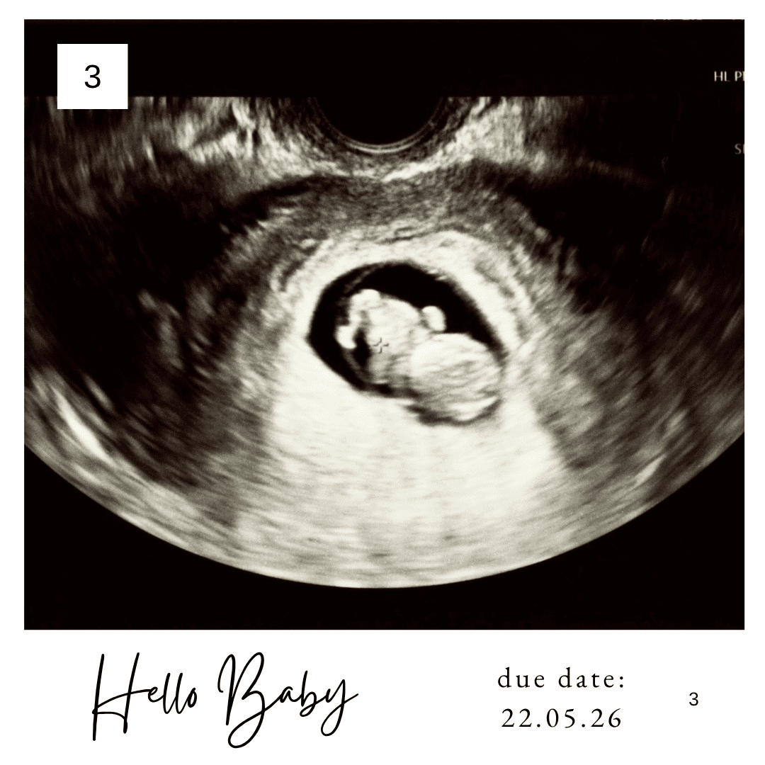 ultralydmotiv fotomagnet